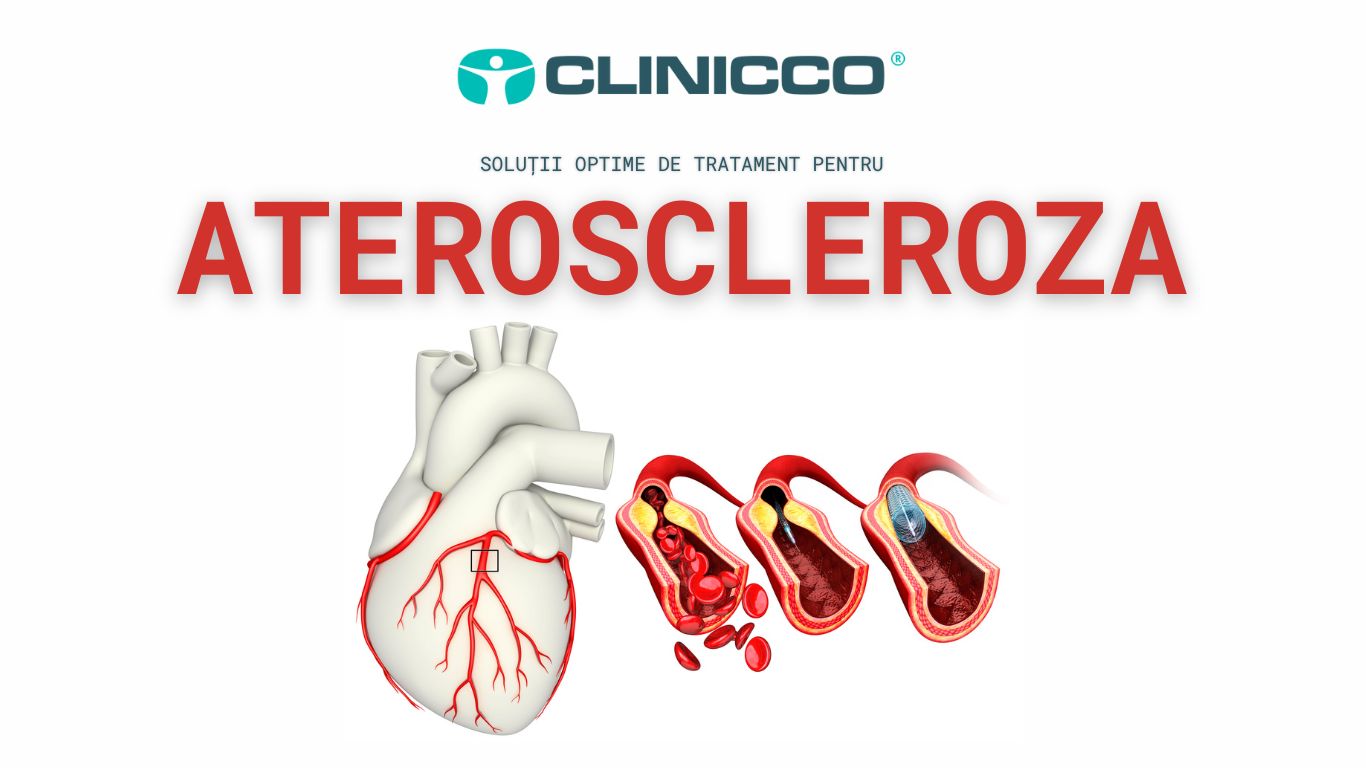 Ateroscleroza: Înțelegerea Profundă a Acestei Afecțiuni Cardiovasculare