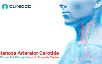 Stenoza Arterelor Carotide: O Perspectivă Chirurgicală