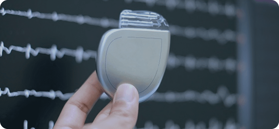 A national first among private hospitals in Romania - the first patient to have a cardiac defibrillator lead replaced